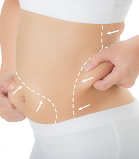 Vlcc For Weight Loss Beauty Dermat Laser Hair Transplant Salon