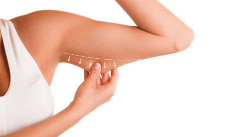 Is CoolSculpting Arms Safe? What to expect from the treatment?