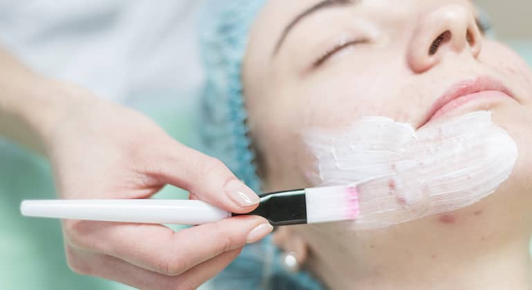DIY Facials for Acne - Check these General Skincare Steps