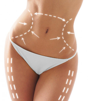 كيرف إكسبرت